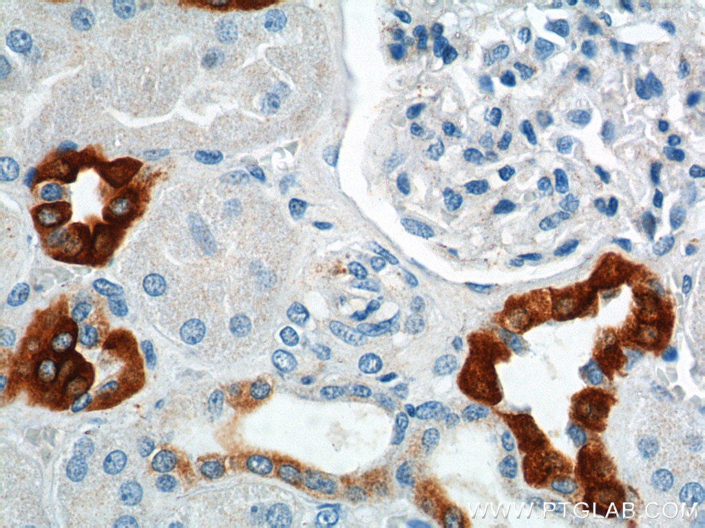 Immunohistochemistry (IHC) staining of human kidney tissue using GPRC5D Polyclonal antibody (21089-1-AP)