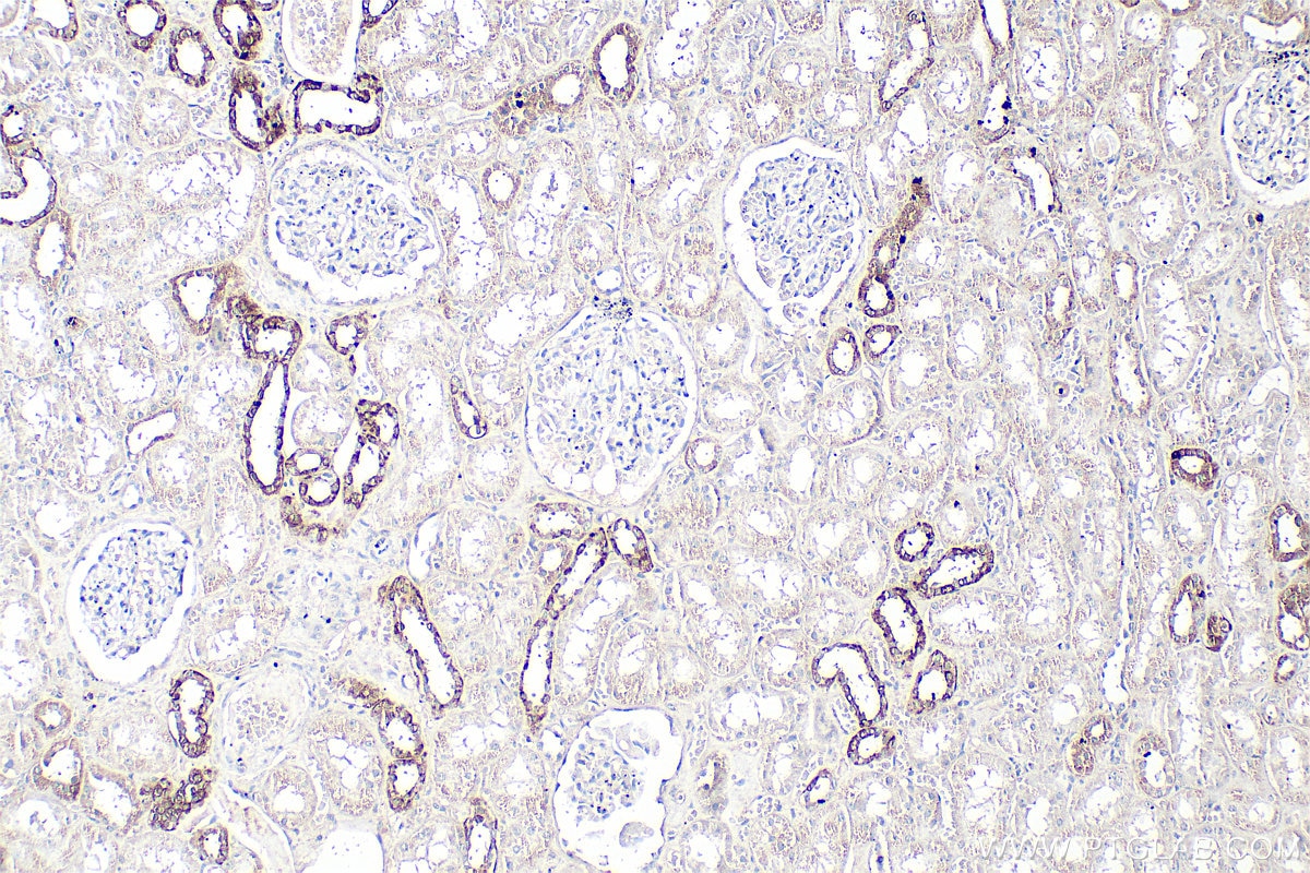 Immunohistochemistry (IHC) staining of human kidney tissue using GPRC5D Polyclonal antibody (21089-1-AP)