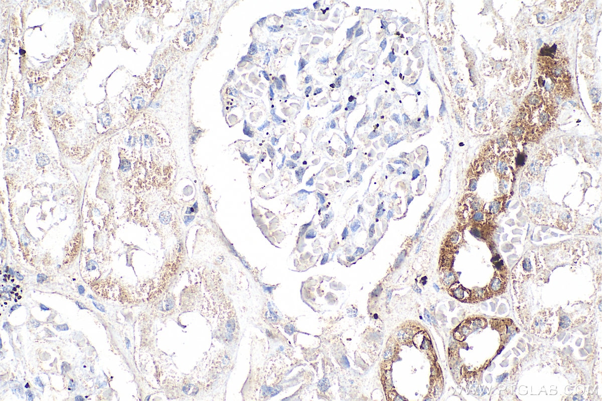 Immunohistochemistry (IHC) staining of human kidney tissue using GPRC5D Polyclonal antibody (21089-1-AP)