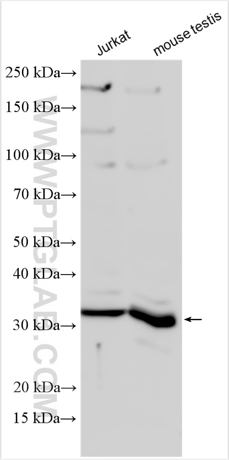 Western Blot (WB) analysis of various lysates using GPRC5D Polyclonal antibody (21089-1-AP)