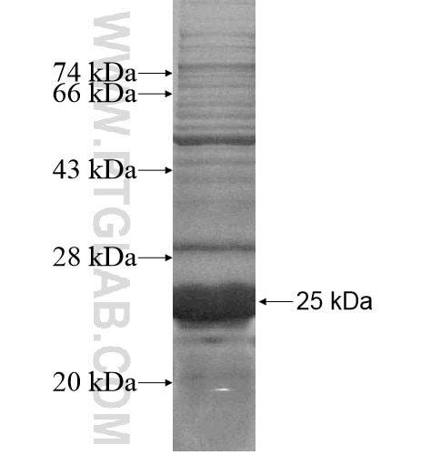 GPRC5D fusion protein Ag15215 SDS-PAGE