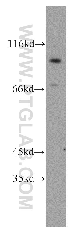 Western Blot (WB) analysis of mouse brain tissue using GPRIN3-Specific Polyclonal antibody (20212-1-AP)