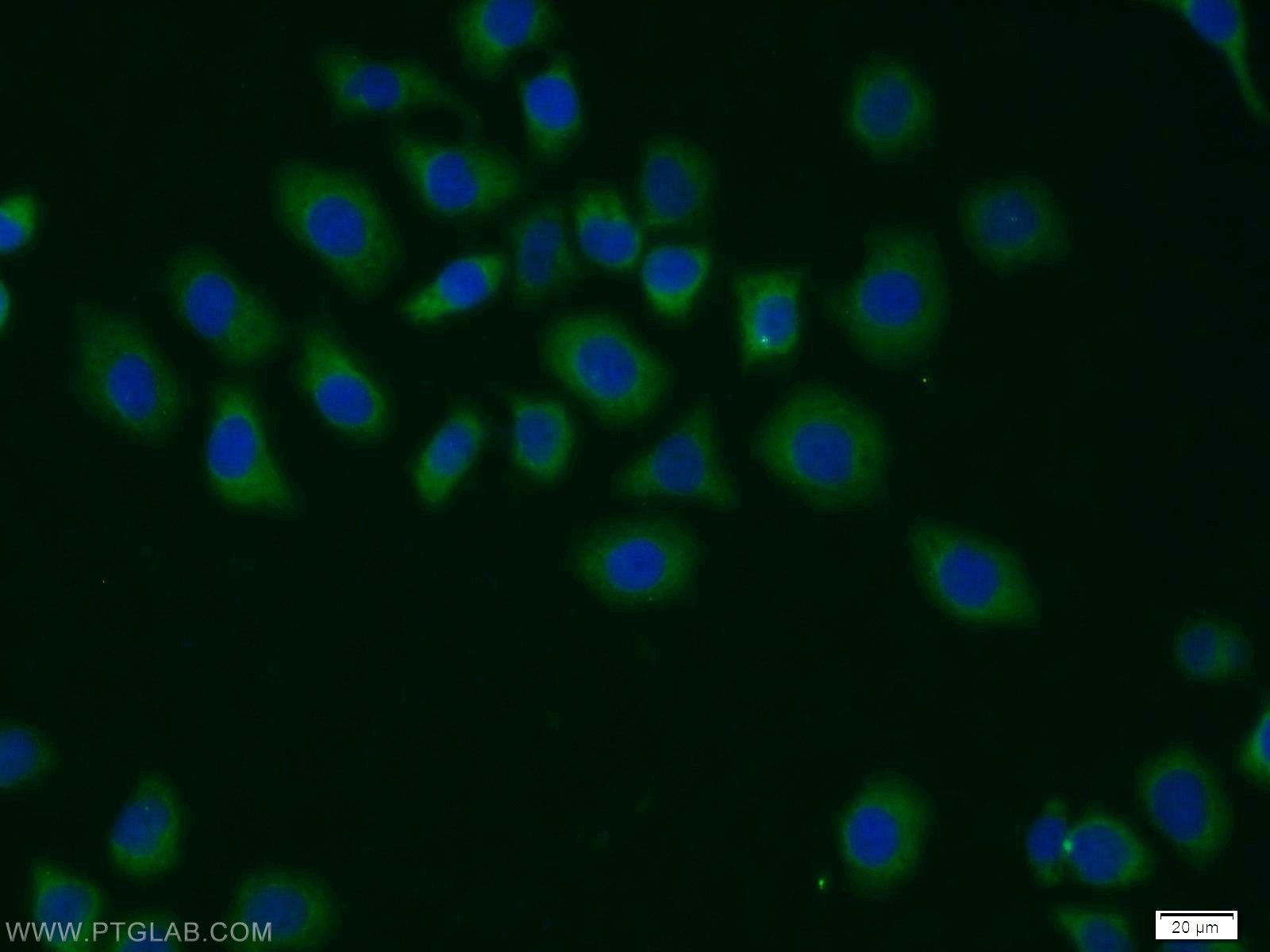 Immunofluorescence (IF) / fluorescent staining of MCF-7 cells using CSN1 Polyclonal antibody (11709-1-AP)