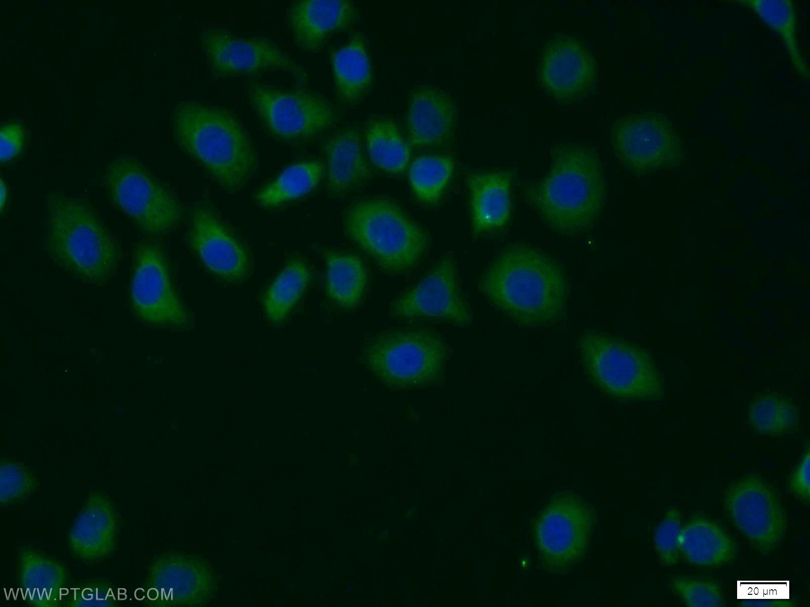 IF Staining of MCF-7 using 11709-1-AP