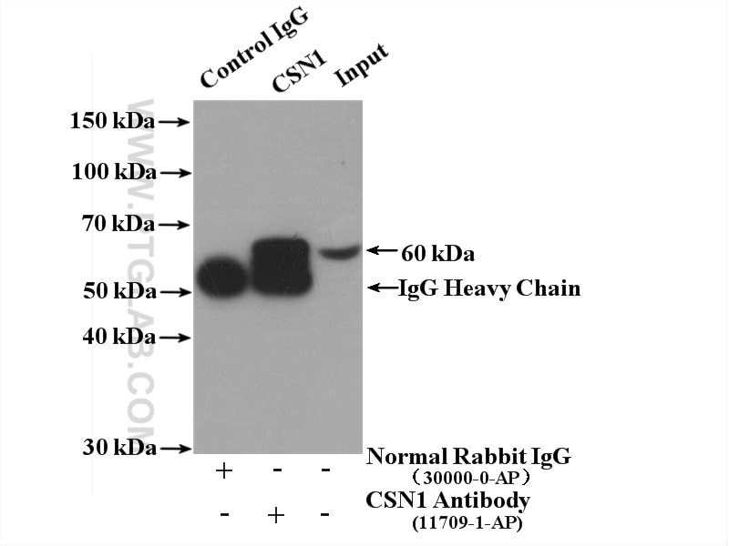Immunoprecipitation (IP) experiment of HeLa cells using CSN1 Polyclonal antibody (11709-1-AP)