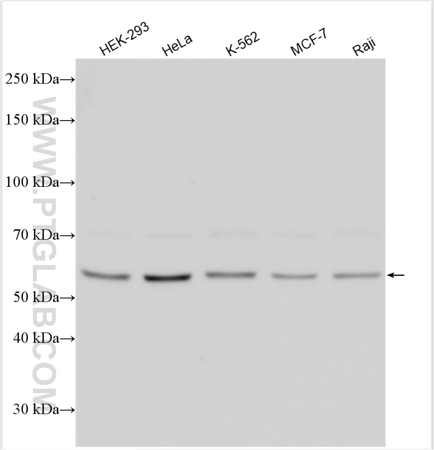 Western Blot (WB) analysis of various lysates using CSN1 Polyclonal antibody (11709-1-AP)
