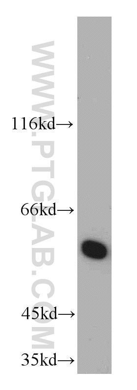 Western Blot (WB) analysis of MCF-7 cells using CSN1 Polyclonal antibody (11709-1-AP)