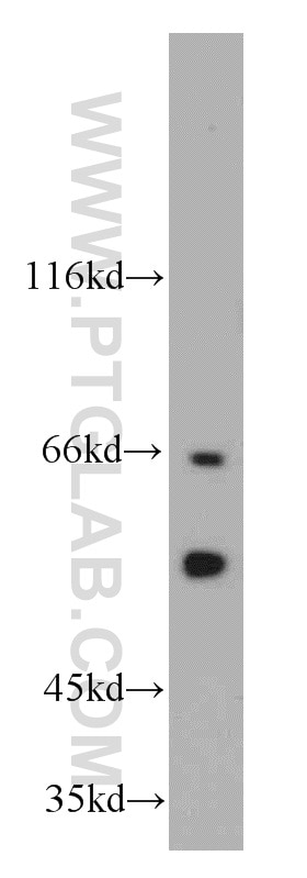 Western Blot (WB) analysis of K-562 cells using CSN1 Polyclonal antibody (11709-1-AP)
