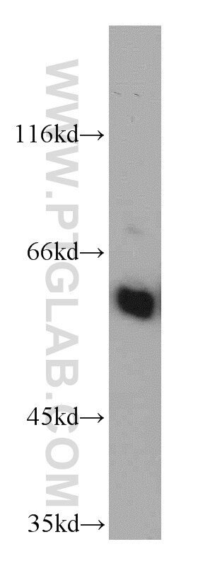 Western Blot (WB) analysis of HEK-293 cells using CSN1 Polyclonal antibody (11709-1-AP)