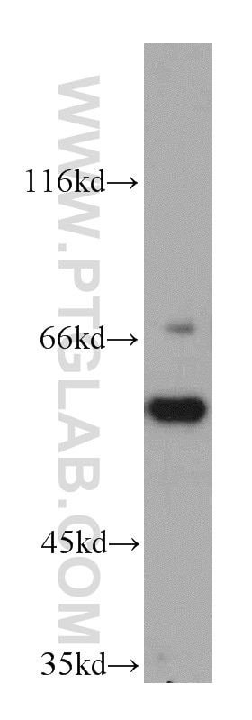 Western Blot (WB) analysis of Raji cells using CSN1 Polyclonal antibody (11709-1-AP)