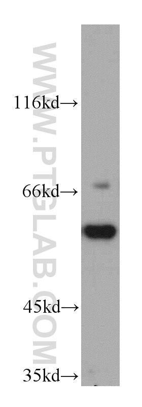 Western Blot (WB) analysis of Raji cells using CSN1 Polyclonal antibody (11709-1-AP)