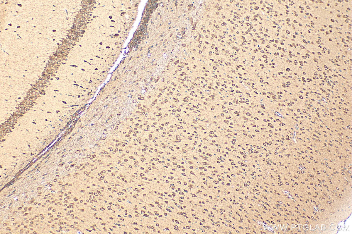 Immunohistochemistry (IHC) staining of mouse brain tissue using GPSM1 Polyclonal antibody (11483-1-AP)