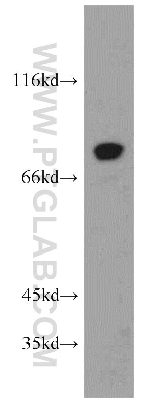 Western Blot (WB) analysis of mouse brain tissue using GPSM1 Polyclonal antibody (11483-1-AP)