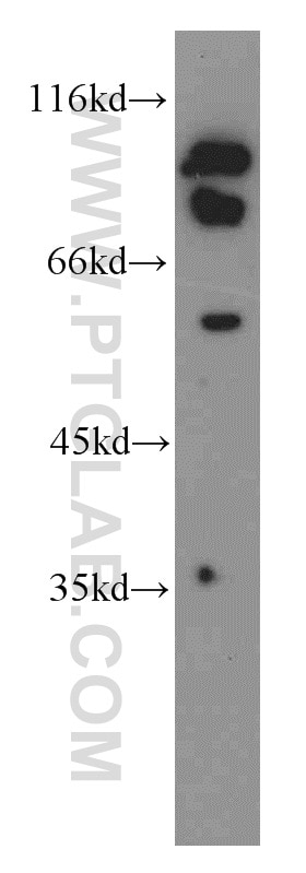 Western Blot (WB) analysis of mouse testis tissue using GPSM1 Polyclonal antibody (11483-1-AP)