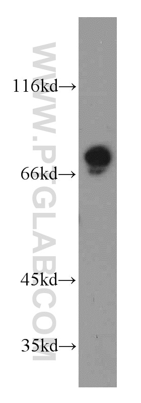 Western Blot (WB) analysis of HeLa cells using GPSM1 Polyclonal antibody (11483-1-AP)