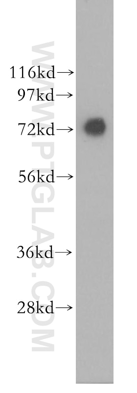 Western Blot (WB) analysis of human brain tissue using GPSM1 Polyclonal antibody (11483-1-AP)