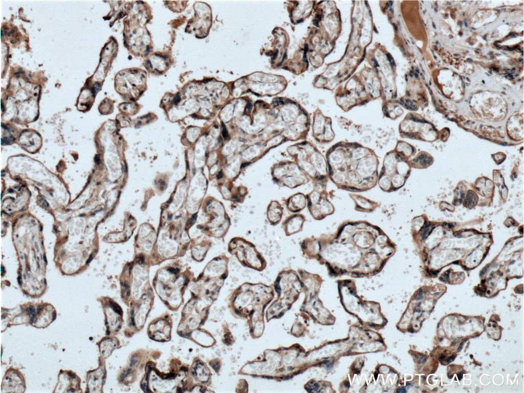 Immunohistochemistry (IHC) staining of human placenta tissue using GPSM2 Polyclonal antibody (26798-1-AP)