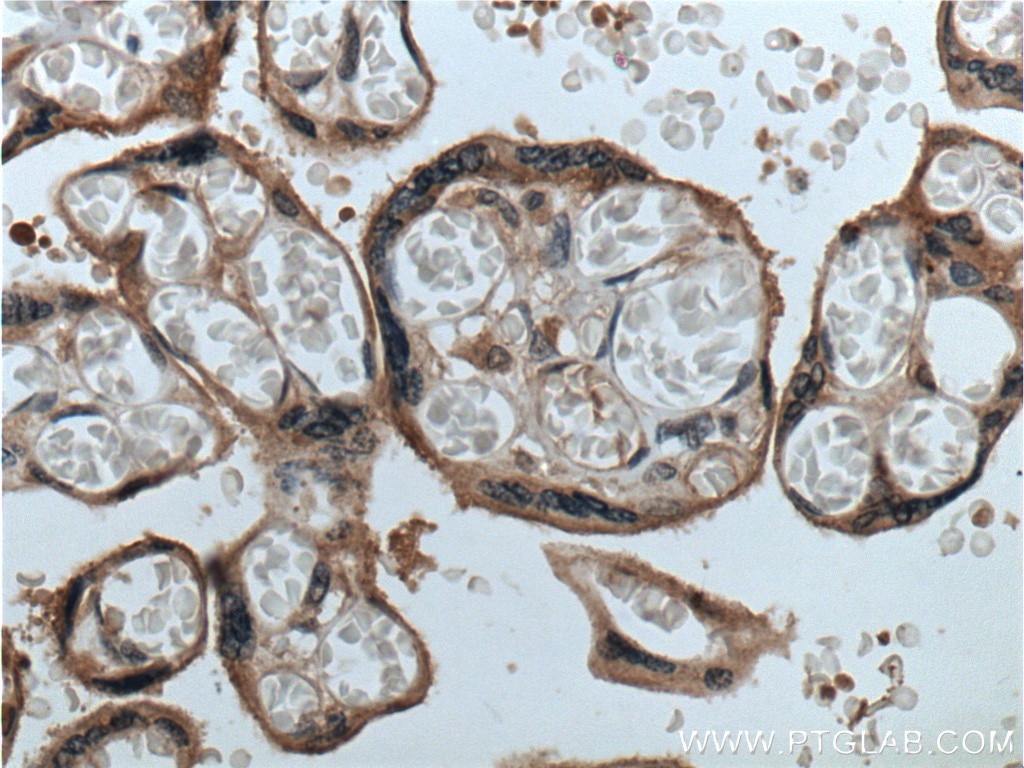 Immunohistochemistry (IHC) staining of human placenta tissue using GPSM2 Polyclonal antibody (26798-1-AP)