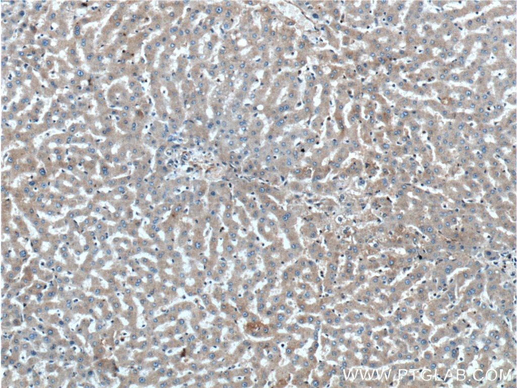 Immunohistochemistry (IHC) staining of human liver tissue using GPSM2 Polyclonal antibody (26798-1-AP)