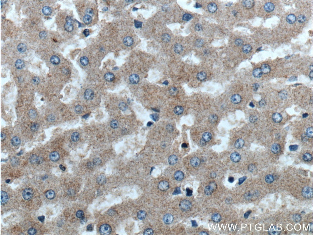 Immunohistochemistry (IHC) staining of human liver tissue using GPSM2 Polyclonal antibody (26798-1-AP)