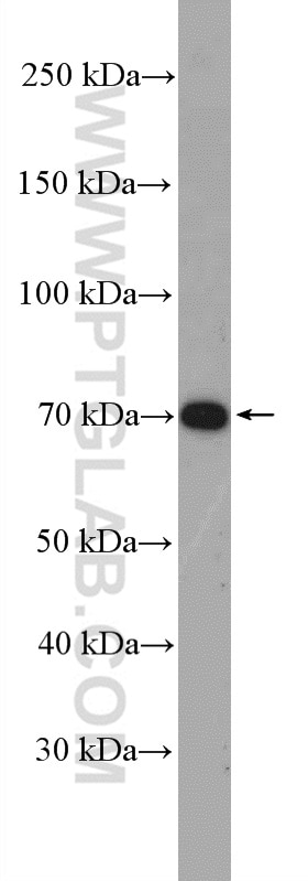 Western Blot (WB) analysis of mouse heart tissue using GPSM2 Polyclonal antibody (26798-1-AP)