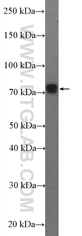 WB analysis of mouse liver using 26798-1-AP