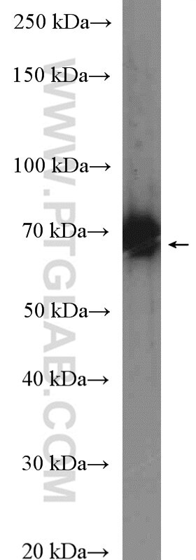 GPSM2