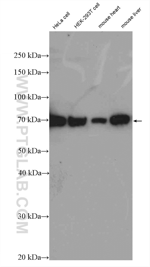 Western Blot (WB) analysis of various lysates using GPSM2 Polyclonal antibody (26798-1-AP)