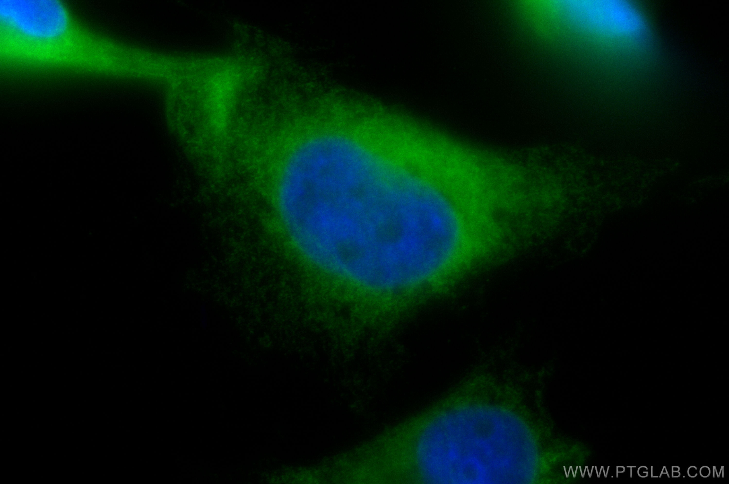 Immunofluorescence (IF) / fluorescent staining of U-251 cells using GPSN2 Polyclonal antibody (30047-1-AP)
