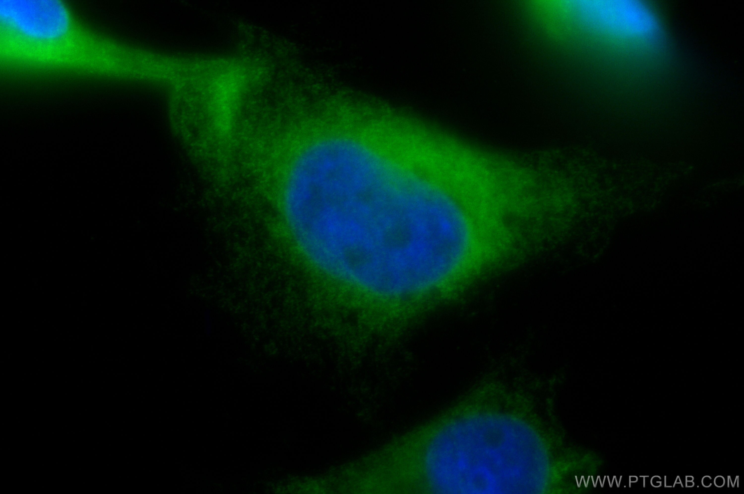 IF Staining of U-251 using 30047-1-AP