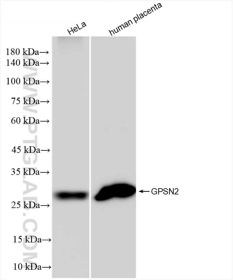 Western Blot (WB) analysis of various lysates using GPSN2 Recombinant antibody (83592-4-RR)