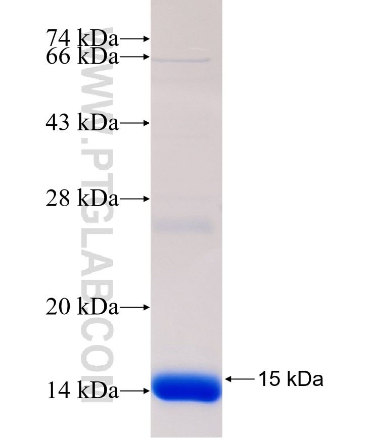 GPSN2 fusion protein Ag32591 SDS-PAGE GPSN2 fusion protein Ag32591 SDS-PAGE