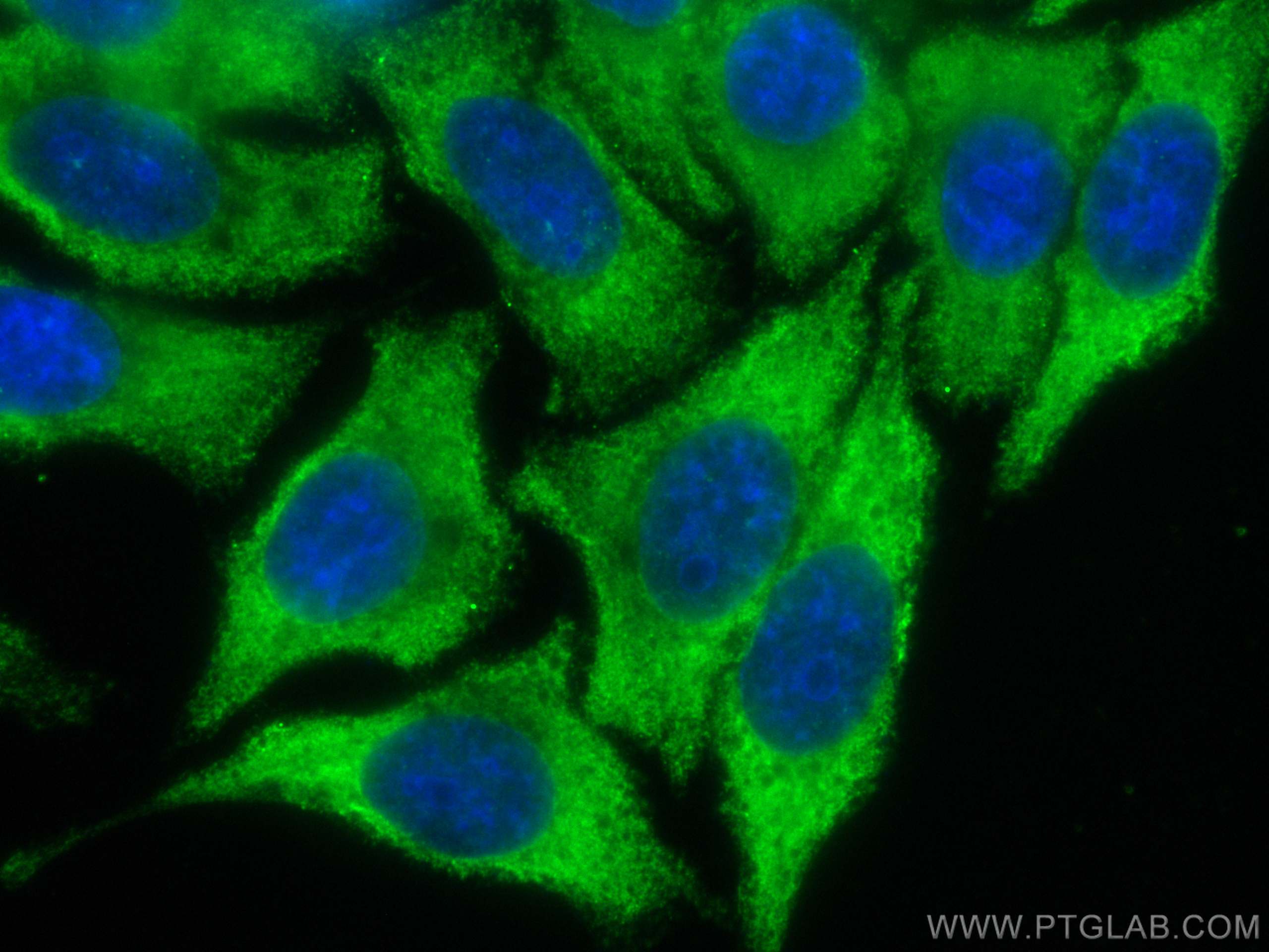 Immunofluorescence (IF) / fluorescent staining of HepG2 cells using CoraLite® Plus 488-conjugated GPT/ALT1 Monoclonal  (CL488-67531)