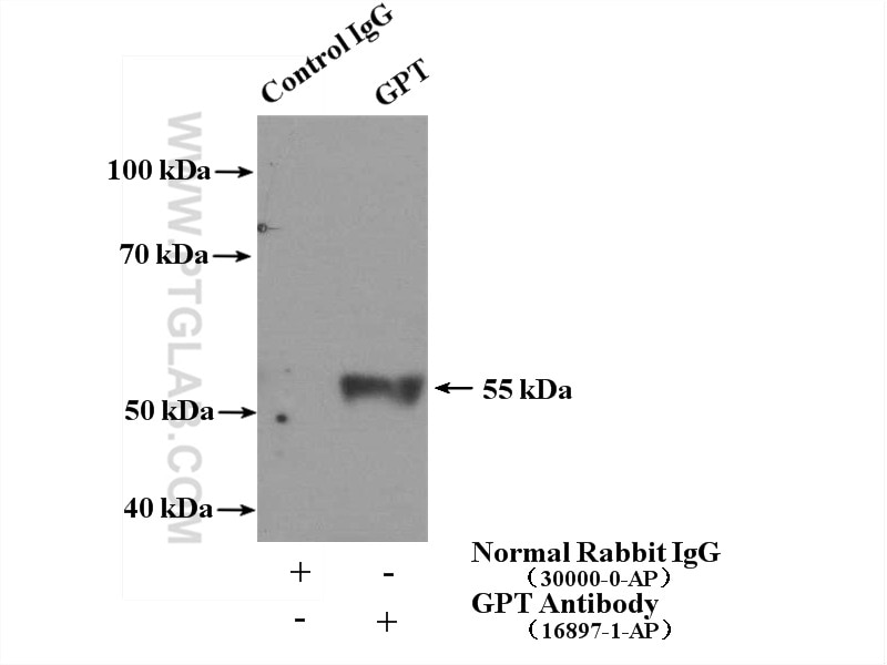 Immunoprecipitation (IP) experiment of L02 cells using GPT/ ALT1 Polyclonal antibody (16897-1-AP)