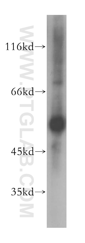 GPT / ALT1 Polyclonal antibody