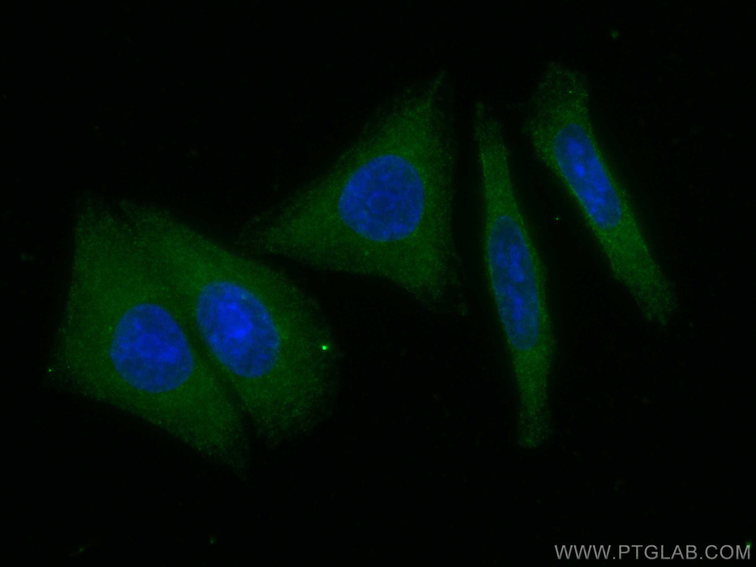 Immunofluorescence (IF) / fluorescent staining of HepG2 cells using GPT/ALT1 Monoclonal antibody (67531-1-Ig)