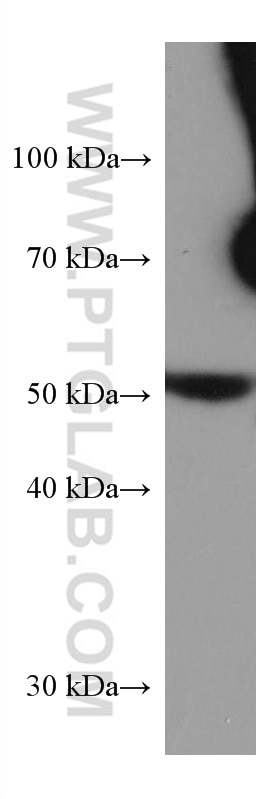 Western Blot (WB) analysis of pig liver tissue using GPT/ALT1 Monoclonal antibody (67531-1-Ig)