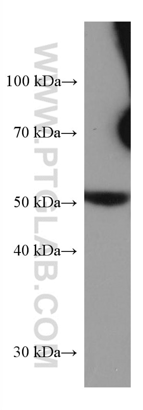 WB analysis of pig liver using 67531-1-Ig