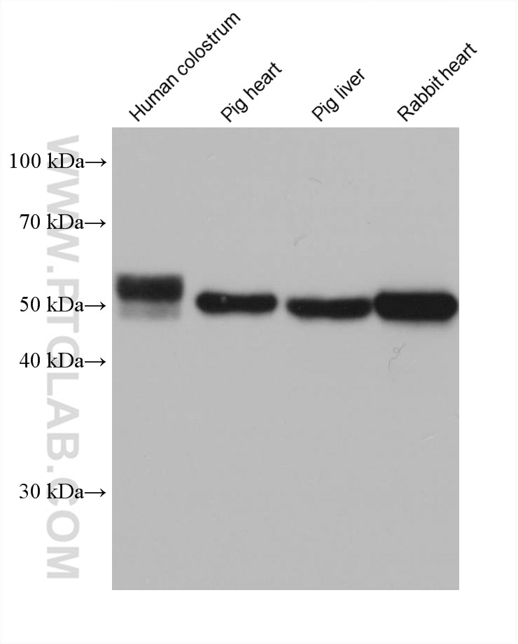 Western Blot (WB) analysis of various lysates using GPT/ALT1 Monoclonal antibody (67531-1-Ig)