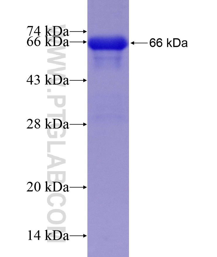 GPT fusion protein Ag10424 SDS-PAGE