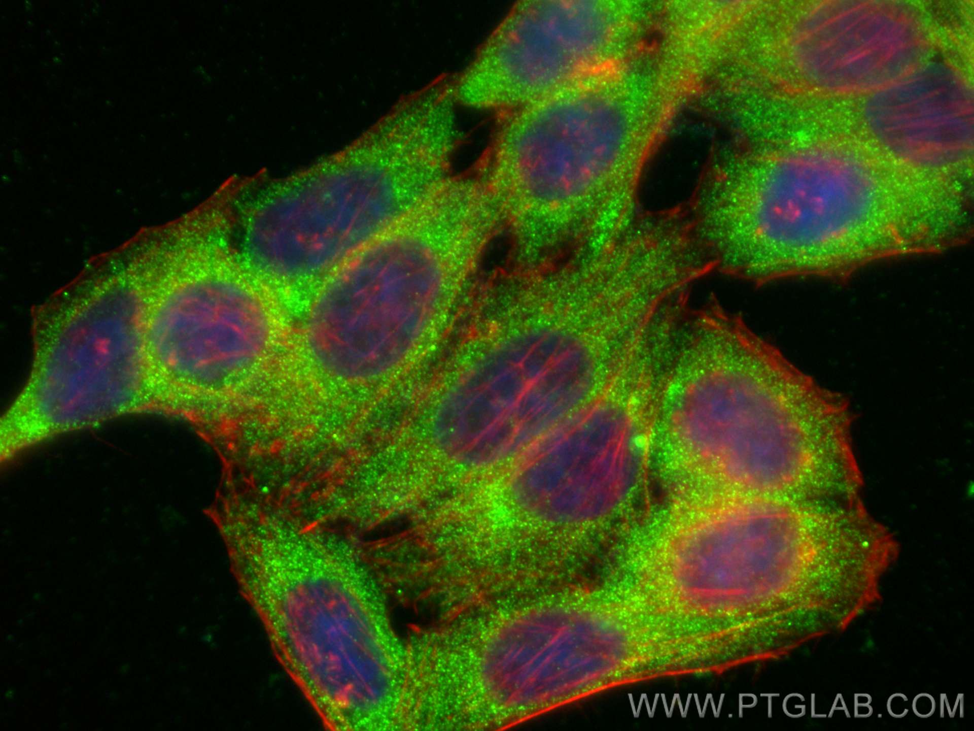 Immunofluorescence (IF) / fluorescent staining of HepG2 cells using GPT2 Polyclonal antibody (16757-1-AP)