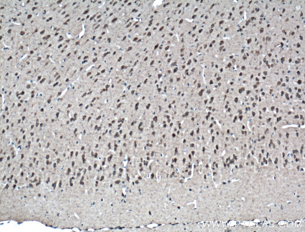 Immunohistochemistry (IHC) staining of mouse brain tissue using GPT2 Polyclonal antibody (16757-1-AP)