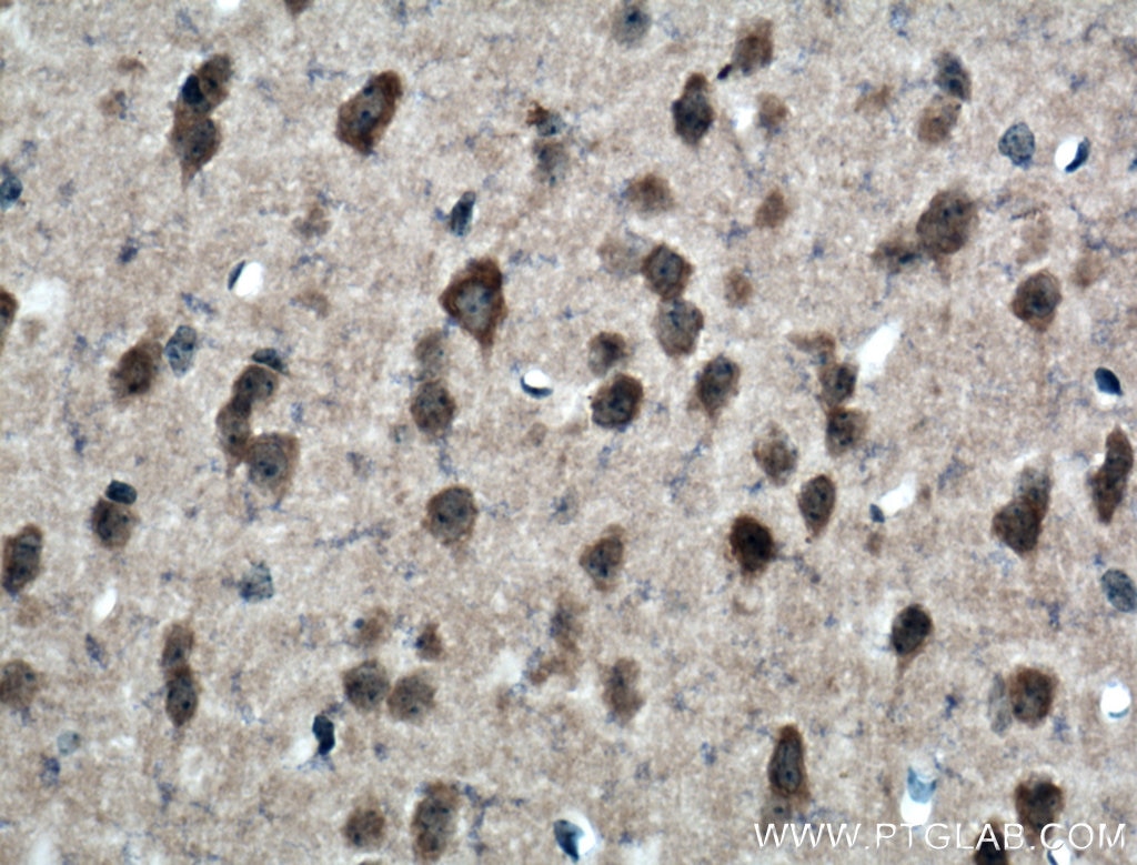 Immunohistochemistry (IHC) staining of mouse brain tissue using GPT2 Polyclonal antibody (16757-1-AP)