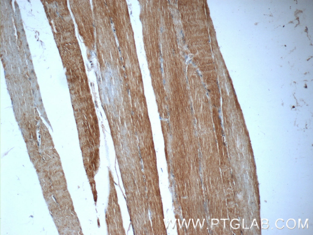 Immunohistochemistry (IHC) staining of human skeletal muscle tissue using GPT2 Polyclonal antibody (16757-1-AP)