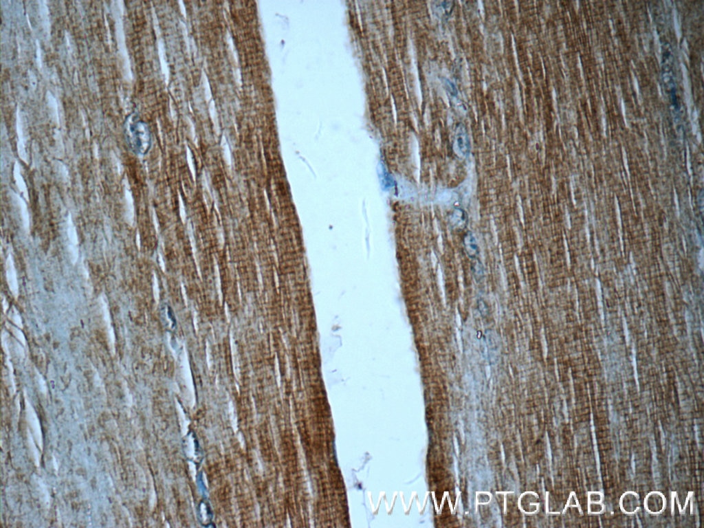 Immunohistochemistry (IHC) staining of human skeletal muscle tissue using GPT2 Polyclonal antibody (16757-1-AP)