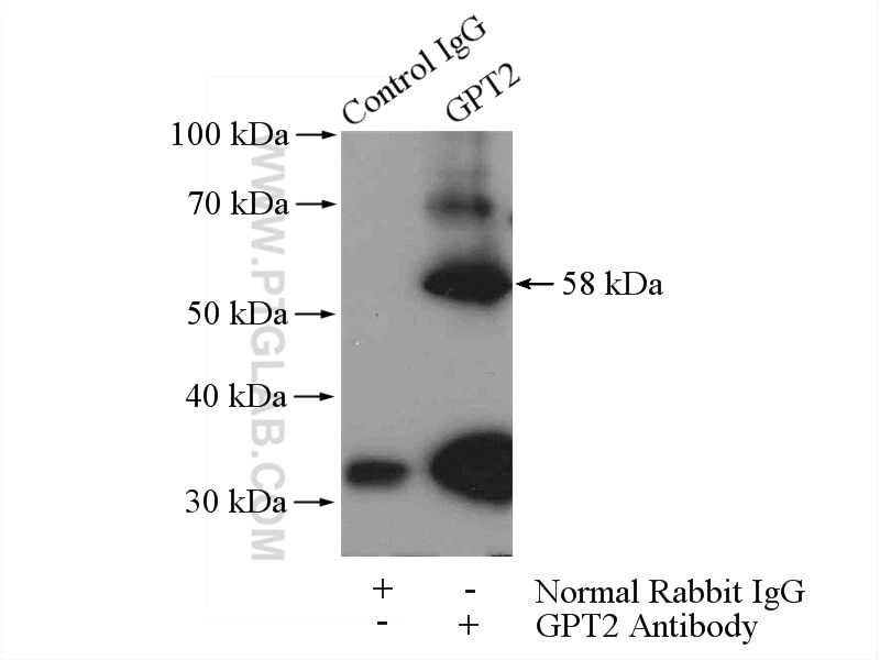 Immunoprecipitation (IP) experiment of mouse kidney tissue using GPT2 Polyclonal antibody (16757-1-AP)