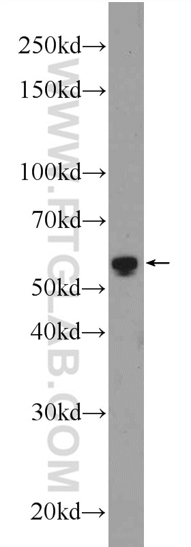 Western Blot (WB) analysis of mouse kidney tissue using GPT2 Polyclonal antibody (16757-1-AP)