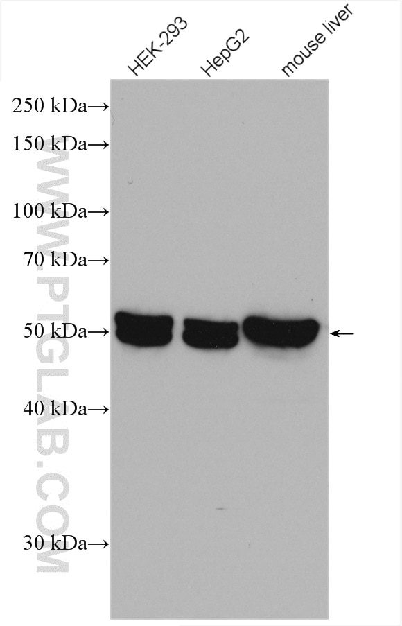 Western Blot (WB) analysis of various lysates using GPT2 Polyclonal antibody (16757-1-AP)