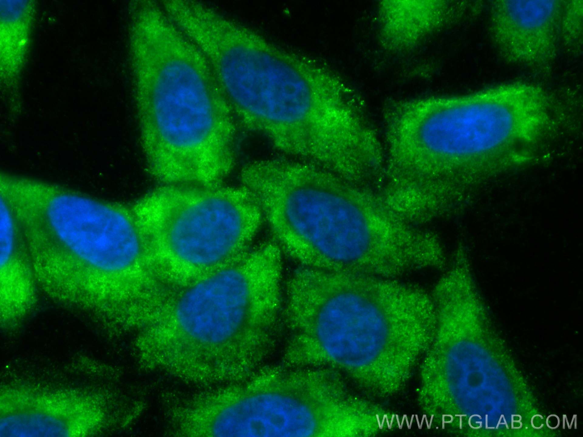 Immunofluorescence (IF) / fluorescent staining of HepG2 cells using CoraLite® Plus 488-conjugated GPT2 Polyclonal anti (CL488-16757)