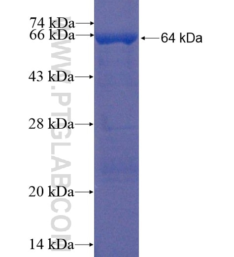 GPT2 fusion protein Ag10273 SDS-PAGE